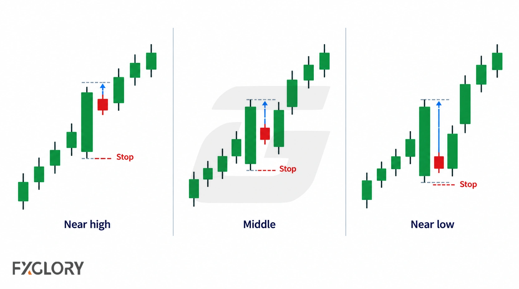 Three inside bar examples positioned near the mother bar high, middle, and low with different breakout and stop distances.